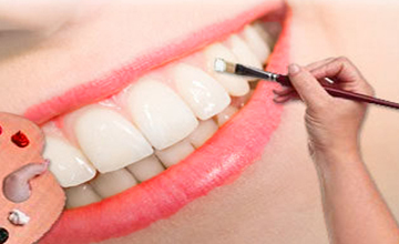 Seminol Dental Cosmetic Dentistry service